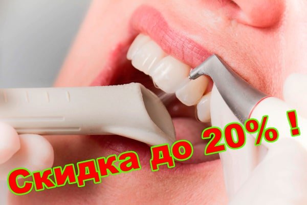профессиональная чистка зубов Донецк